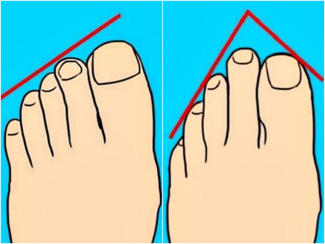 8가지 유형의 '발가락 모양'으로 알아보는 성격 테스트