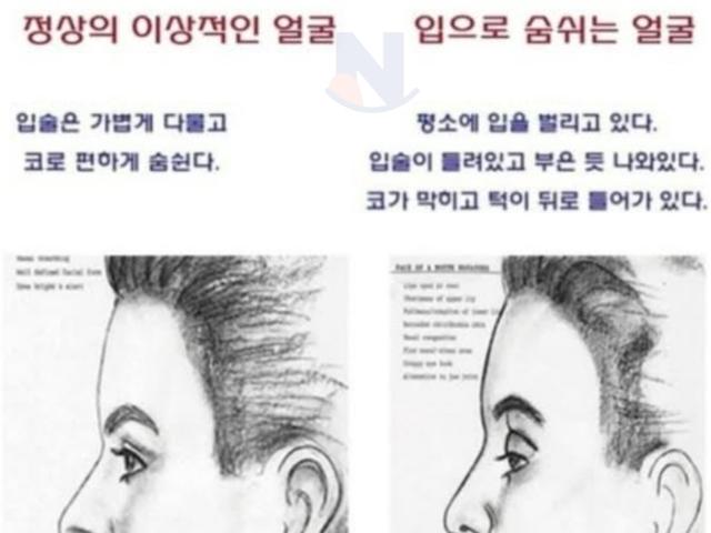 정상의 <strong>이상</strong>적인 얼굴 vs 입으로 숨쉬는 얼굴..ㄷㄷㄷ