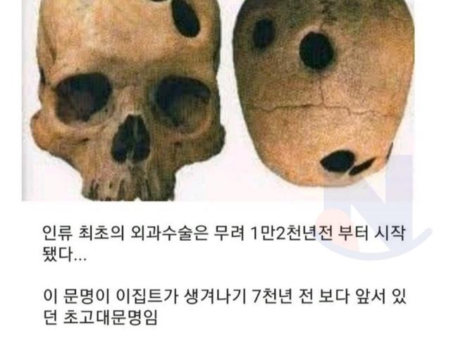 12000년전에 행해<strong>진</strong> 뇌수술 ㄷㄷ..jpg